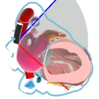 ME Left Atrial Appendage View