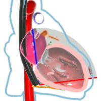 TG 2 Chamber View