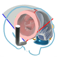 TG Basal Sax View