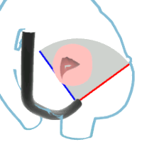 TG Apical SAX View