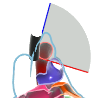 UE Aortic Arch SAX View