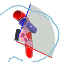 UE Left Pulmonary Veins View