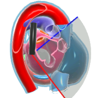 UE Right and Left Pulmonary Veins View