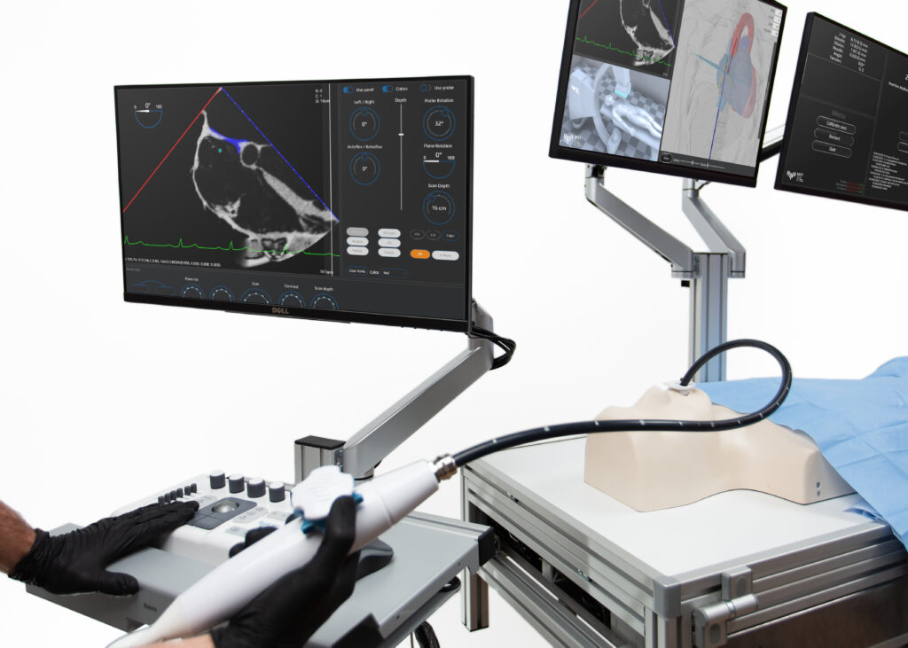 TSP simulator, 3 monitors with Ultrasound image, Fluoroscopic view and simulation details.